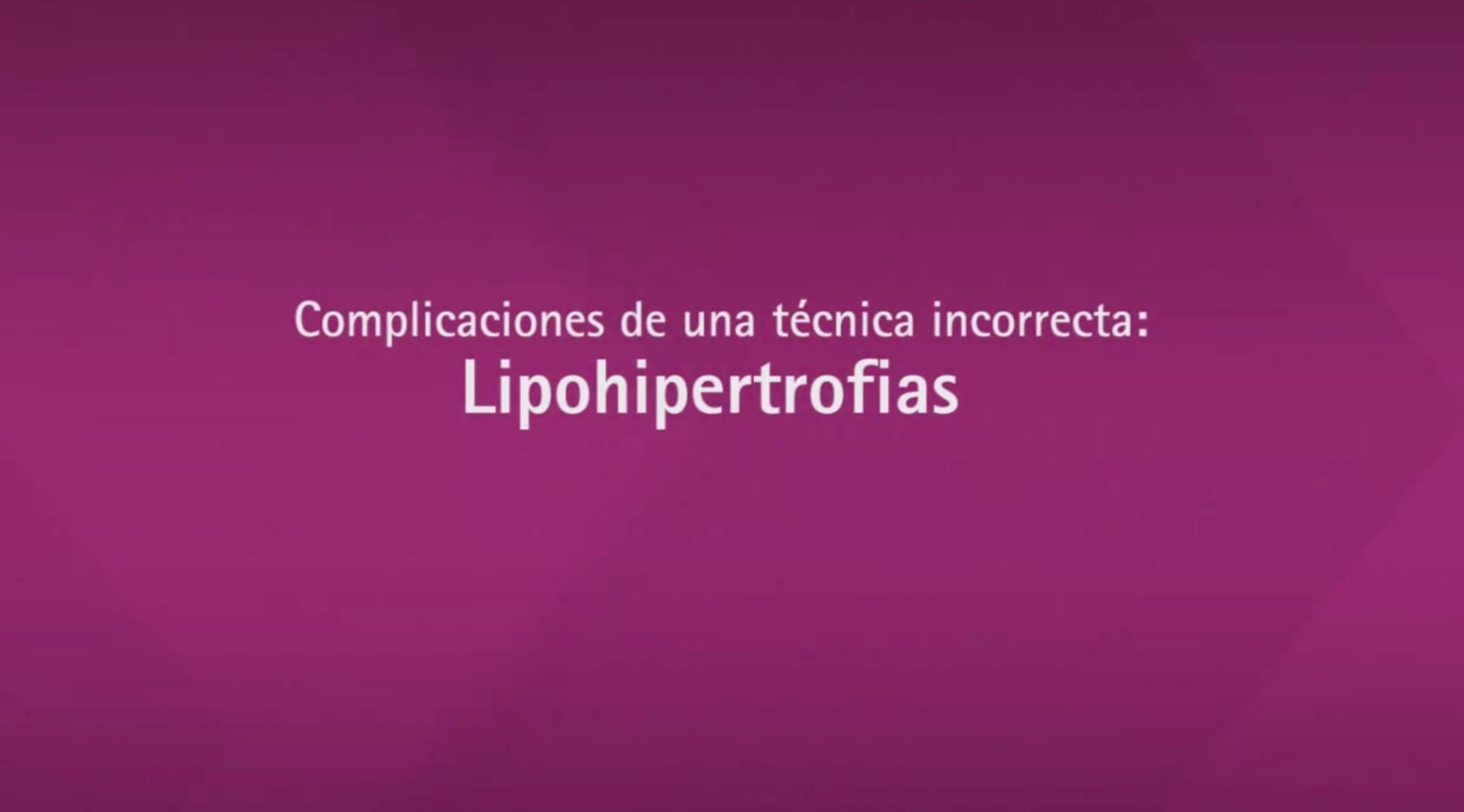 lipo